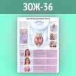 Плакат «Заболевания щитовидной железы» (ЗОЖ-36, ламинир. бумага, А2, 1 лист)